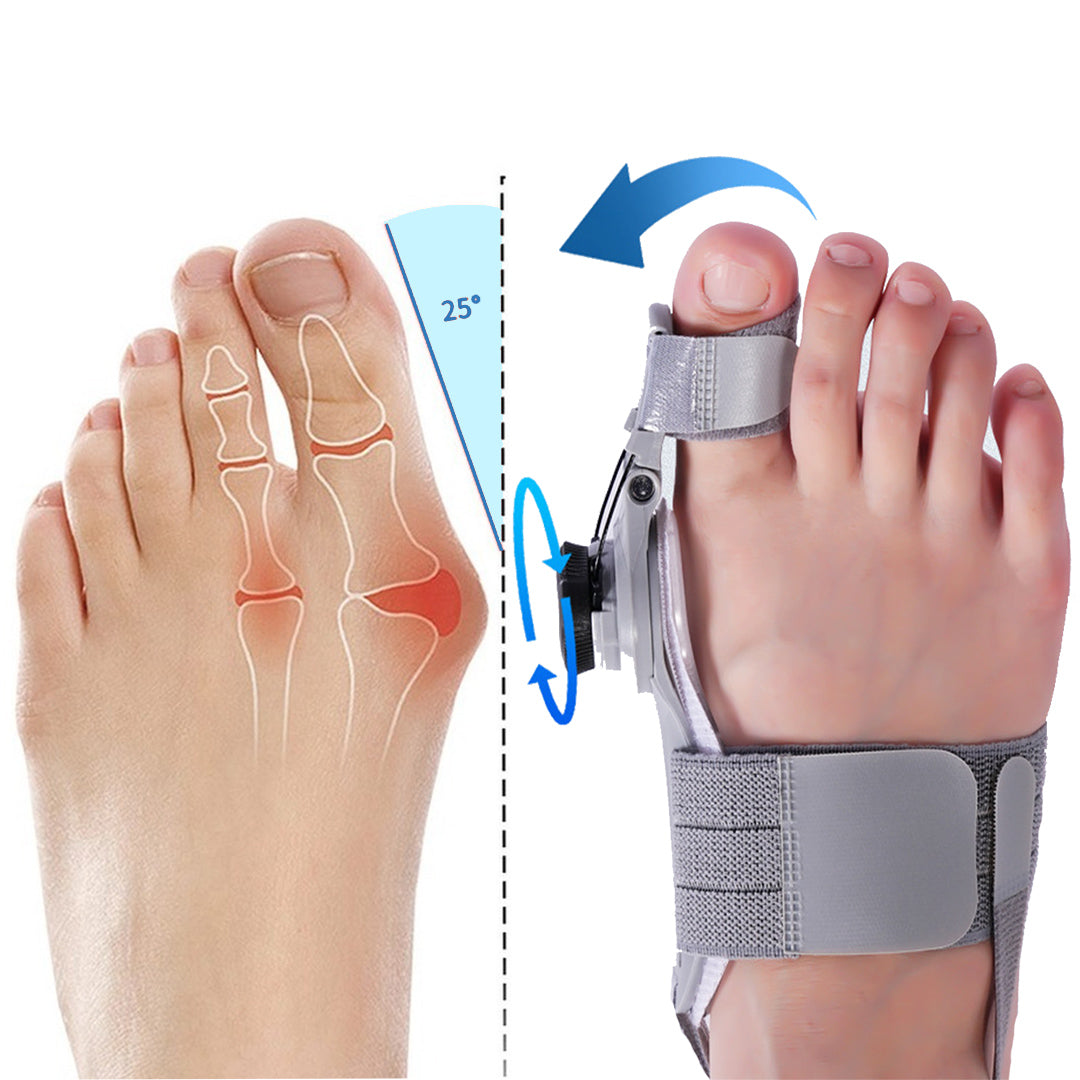 SoniVIta™ Bunion Fix - At-Home Bunion Relief